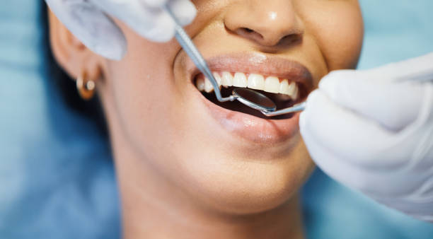 Best Walk-In Emergency Dentist in Metairie, LA